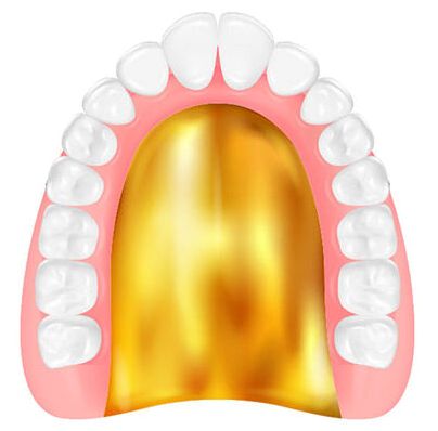 ゴールド床義歯