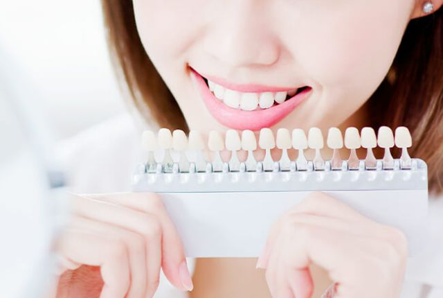 歯の色見本を持って笑う女性